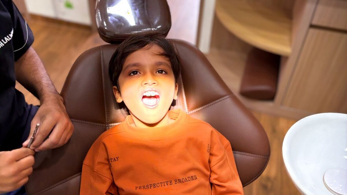 A young patient comfortably smiling in the dental chair at Little Angels Kids Dental Care