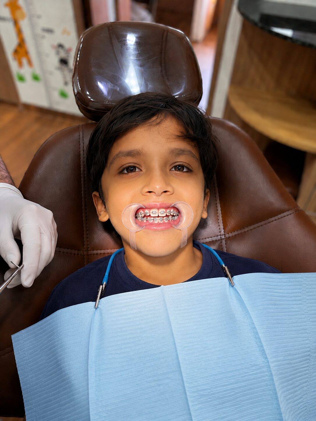 Kids Braces Treatment